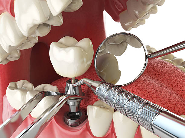 Best Emergency Broken Tooth Repair in Southwest Greensburg, PA